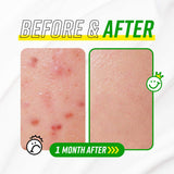 Have A Good Cream Snail & Centella - Korean-Skincare