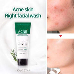 Some By Mi AHA BHA PHA 30 Days Miracle Acne Foam - Korean-Skincare